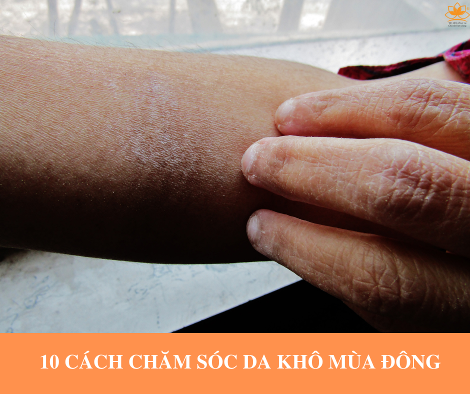 10 CÁCH CHĂM SÓC DA KHÔ MÙA ĐÔNG